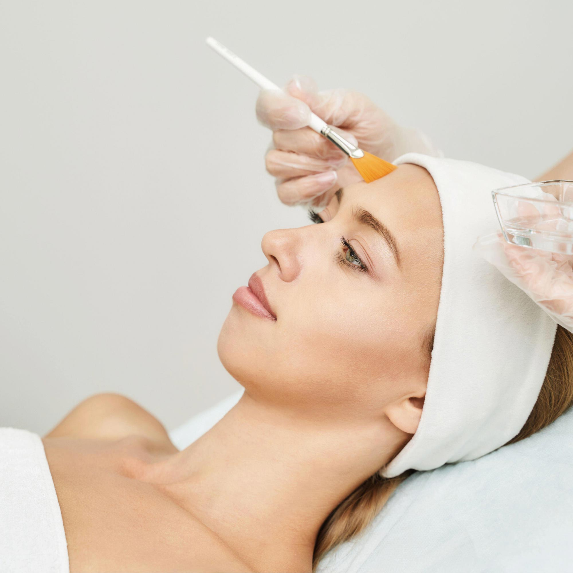 #8-Acne-Scar-Revision